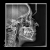 Vatech PaX-i 3D 10x8.5 - компьютерный томограф